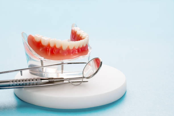 Dental Bonding in Redstone Arsenal, AL